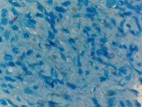 Bone marrow -Zeihl Neelson stain