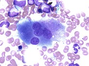 Osteoclast - 1.