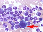 Megakaryocytic maturation - 1.