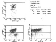 Mantle cell lymphoma -CSF