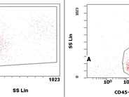 T/myeloid AML - 2.