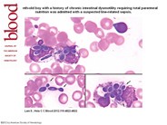 Peripheral blood candidiasis