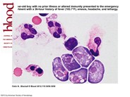 Naegleria fowleri meningoencephalitis