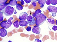Mott cell - 1.