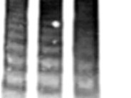 Thrombotic Thrombocytopenic Purpura - 8.