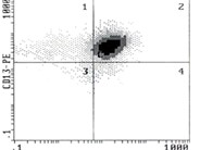 Precursor T-Lymphoblastic Leukemia/Lymphoma - 4.