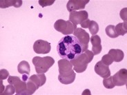 Neutrophils - 1.