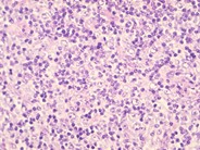 Normal Lymphoid Tissues: Part 2 - 1.