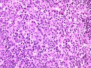 Normal Lymphoid Tissues: Part 2 - 5.