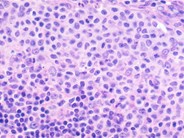 Normal Lymphoid Tissues: Part 3 - 2.