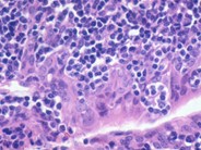 Normal Lymphoid Tissues: Part 4 - 10.