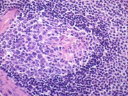 Normal Lymphoid Tissues: Part 4 - 3.