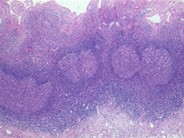 Normal Lymphoid Tissues: Part 4 - 7.