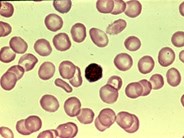 ITP smear