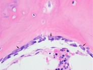 Bone Marrow Osteoblasts - 2.