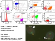 Burkitt Leukemia