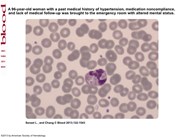 Platelet phagocytosis by neutrophils
