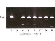 Adult T-cell Leukemia/Lymphoma - 6.