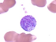 Giant Platelet - 1.