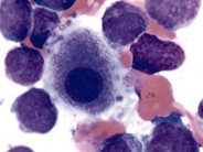 Micromegakaryocyte - 1.