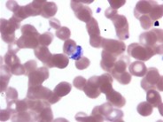 Plasmodium Vivax - 3.