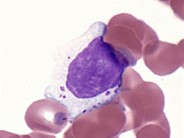 Large Granular Lymphocyte - 1.