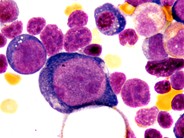 Parvovirus Inclusions - 2.