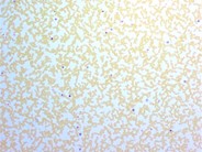 Leukocyte Alkaline Phosphatase Scoring - 1.