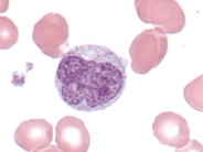 Monocyte - 1.