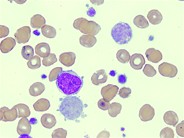 Megakaryocyte Fragment - 1.