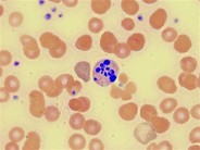 Neutrophil Apoptotis - 1.