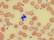 Neutrophil Apoptotis - 2.