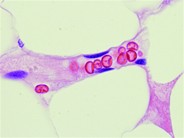 Bone Marrow Capillary - 1.