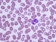Leukocyte Phagocytosis of Platelets - 4.