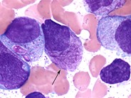 Faggot cell - 1.