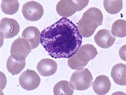 Basophils - 2.