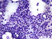 Normal adult bone marrow aspirate - 2.