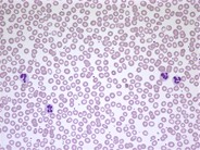 Normal peripheral blood smear - 1.
