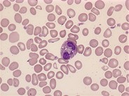 Eosinophils - 1.