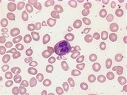 Eosinophils - 2.