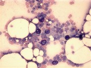Mast cells - 1.