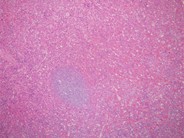 Normal spleen - 1.