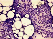 CLL - 1.