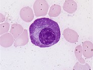 Flame cell - 1.