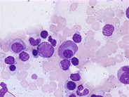 Flame cell - 2.