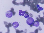 LE cells in BMA