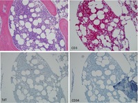 T cell ALL Special Stains