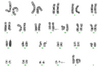t922-Karyotype
