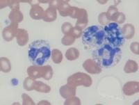 Histoplasma in peripheral blood