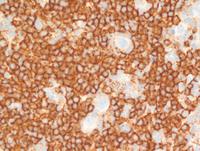 CD20-stainHRS-cells-are-negative